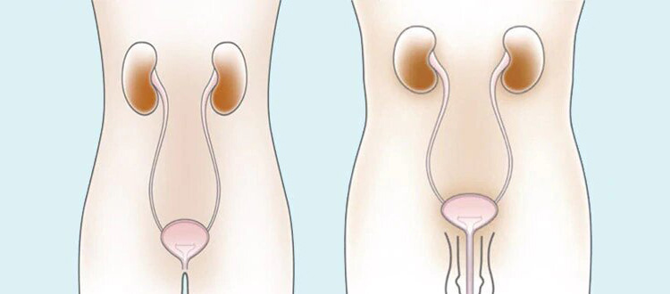 remedii populare pentru tratamentul prostatitei recenzii tratament incepator pentru prostatita